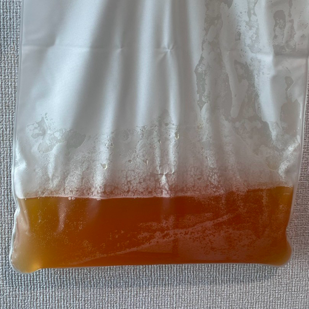 慢性發炎血漿外觀示意圖