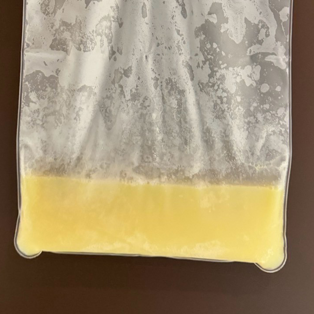 乳糜血漿外觀示意圖